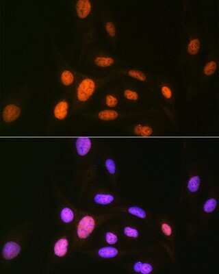 Immunocytochemistry/ Immunofluorescence: CaMKIV Antibody (1G4P4) [NBP3-16802]