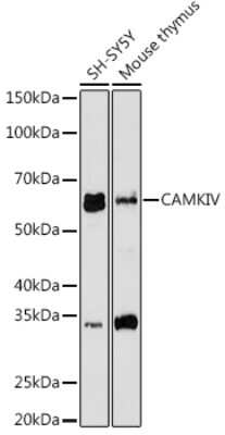 Western Blot: CaMKIV Antibody (1G4P4) [NBP3-16802]