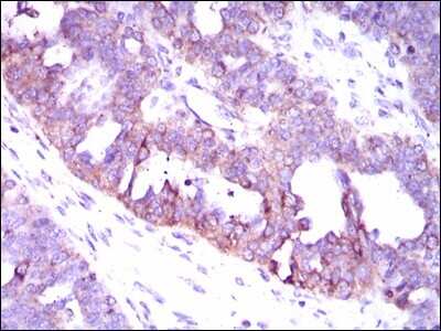 Immunohistochemistry: CaMKIV Antibody (8C5B8) - BSA Free [NBP2-37428]