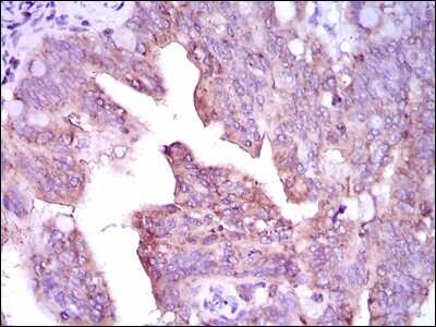 Immunohistochemistry: CaMKIV Antibody (8C5B8) - BSA Free [NBP2-37428]