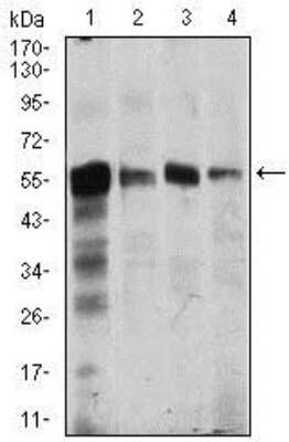 Western Blot: CaMKIV Antibody (8C5B8)BSA Free [NBP2-37428]