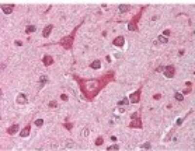 Immunohistochemistry-Paraffin: CaMKIV Antibody [NBP1-78002]