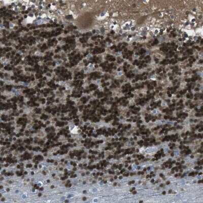 Immunohistochemistry-Paraffin: CaMKIV Antibody [NBP1-88209]