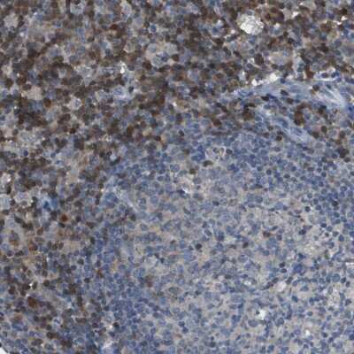 Immunohistochemistry-Paraffin: CaMKIV Antibody [NBP1-88209]