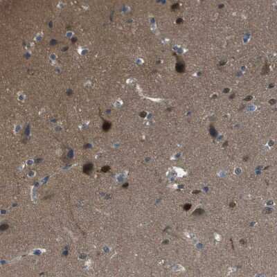 Immunohistochemistry-Paraffin: CaMKIV Antibody [NBP1-88209]