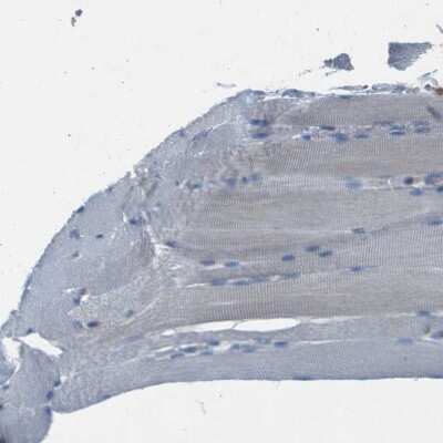 Immunohistochemistry-Paraffin: CaMKIV Antibody [NBP1-88209]