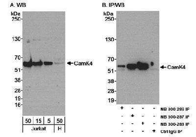 Western Blot: CaMKIV Antibody [NB300-287]