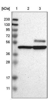 Western Blot: CaMKIV Antibody [NBP1-88210]