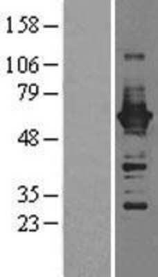 Western Blot: CaMKIV Overexpression Lysate [NBL1-08666]