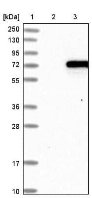 Western Blot: CaMKK alpha Antibody [NBP1-88208]