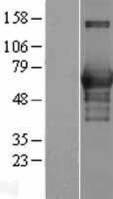 Western Blot: CaMKK alpha Overexpression Lysate [NBP2-05167]