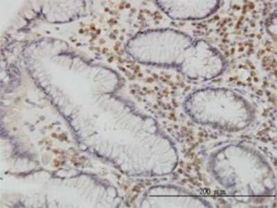 Immunohistochemistry-Paraffin: CaMKK alpha Antibody (1F6) [H00084254-M01]