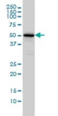 Western Blot: CaMKK alpha Antibody (1F6) [H00084254-M01]