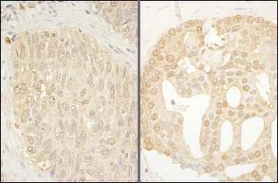 Immunohistochemistry: CaMKK alpha Antibody [NBP1-42682]