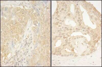Immunohistochemistry-Paraffin: CaMKK alpha Antibody [NBP1-42683]