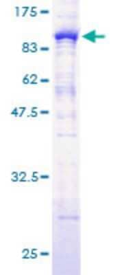 SDS-PAGE: Recombinant Human CaMKK alpha GST (N-Term) Protein [H00084254-P01]