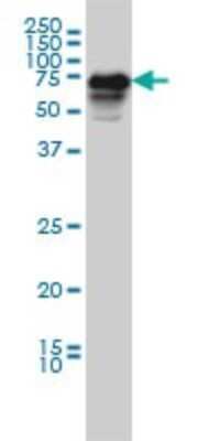 Western Blot: CaMKK2 Antibody (1A11) [H00010645-M01]