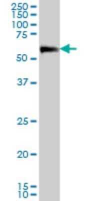 Western Blot: CaMKK2 Antibody (4C7) [H00010645-M02]