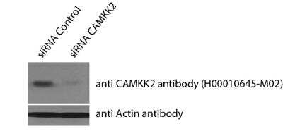 Knockdown Validated: CaMKK2 Antibody (4C7) [H00010645-M02]