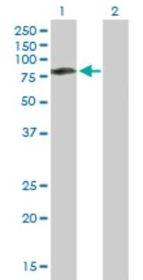 Western Blot: CaMKK2 Antibody [H00010645-B01P]