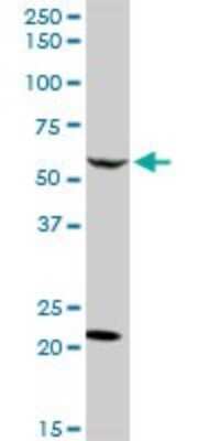 Western Blot: CaMKK2 Antibody [H00010645-D01P]