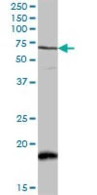 Western Blot: CaMKK2 Antibody [H00010645-D01P]