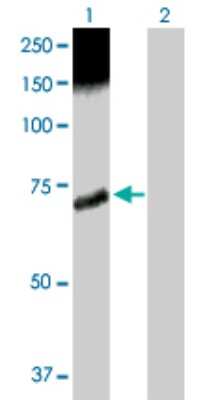 Western Blot: CaMKK2 Antibody [H00010645-D01P]