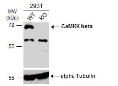 Western Blot: CaMKK2 Antibody [NBP1-31247]