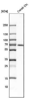 Western Blot: CaMKK2 Antibody [NBP1-86651]