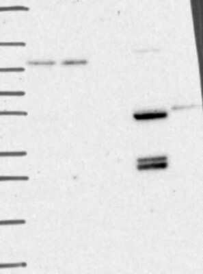 Western Blot: CaMKK2 Antibody [NBP3-17692]