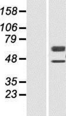 Western Blot: CaMKK2 Overexpression Lysate [NBP2-05245]