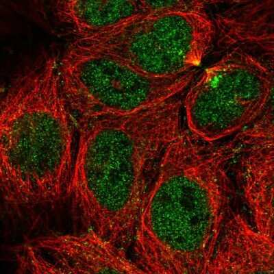 Immunocytochemistry/ Immunofluorescence: CaMKV Antibody [NBP1-82660]