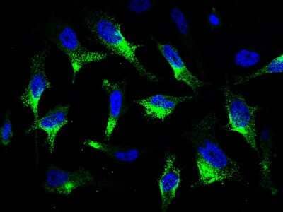 Immunocytochemistry/ Immunofluorescence: CaMKV Antibody [NBP2-99963]