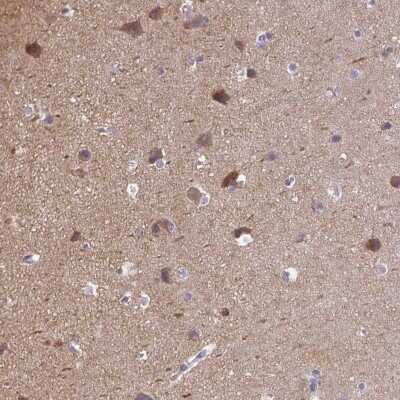 Immunohistochemistry-Paraffin: CaMKV Antibody [NBP1-82660]