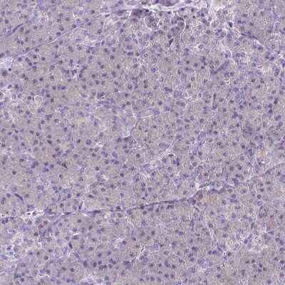 Immunohistochemistry-Paraffin: CaMKV Antibody [NBP1-82660]