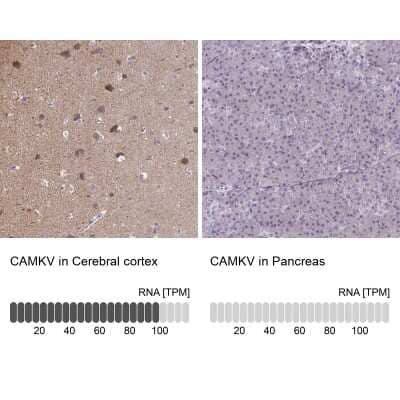 Immunohistochemistry-Paraffin: CaMKV Antibody [NBP1-82660]