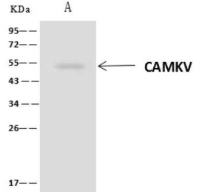 Immunoprecipitation: CaMKV Antibody [NBP3-06485]