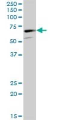 Western Blot: CaMKV Antibody [H00079012-B01P]