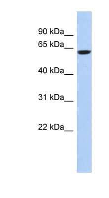 Western Blot: CaMKV Antibody [NBP1-56677]