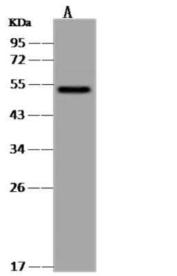 Western Blot: CaMKV Antibody [NBP3-06485]