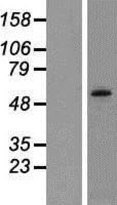 Western Blot: CaMKV Overexpression Lysate [NBP2-06366]