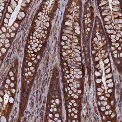 Immunohistochemistry-Paraffin: Cactin Antibody [NBP1-86679]