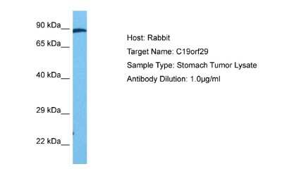 Western Blot: Cactin Antibody [NBP2-87112]