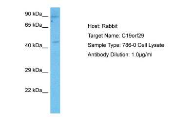 Western Blot: Cactin Antibody [NBP2-87113]