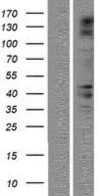 Western Blot: Cactin Overexpression Lysate [NBP2-06542]