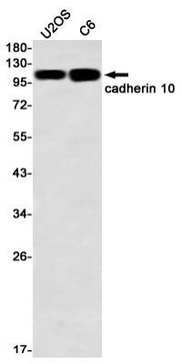 Western Blot: Cadherin-10 Antibody (S07-2E2) [NBP3-19842]