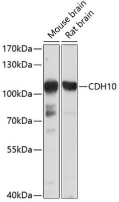 Western Blot: Cadherin-10 AntibodyBSA Free [NBP2-92600]