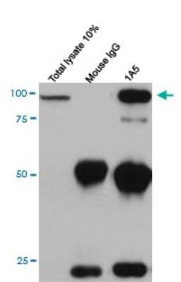 Western Blot: Cadherin-11 Antibody (1A5) [H00001009-M04]