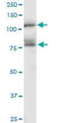 Western Blot: Cadherin-11 Antibody (1A5) [H00001009-M04]