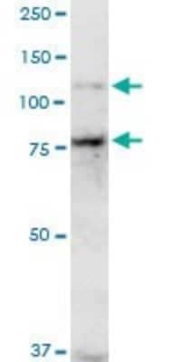 Western Blot: Cadherin-11 Antibody (1A5) [H00001009-M04]